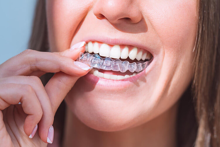 Image representing periodontal care at Burlington Family Dental, focusing on gum health.